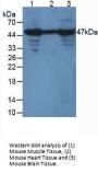 Enolase, Neuron Specific (NSE) Antibody