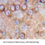 Enolase, Neuron Specific (NSE) Antibody