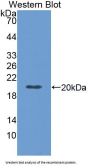 TNF Receptor Superfamily Member 6 / CD95 / TNFRSF6 (FAS) Antibody