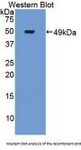 TNF Receptor Superfamily Member 6 / CD95 / TNFRSF6 (FAS) Antibody