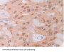 Hepatocyte Growth Factor (HGF) Antibody