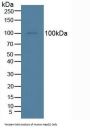Insulin Degrading Enzyme (IDE) Antibody