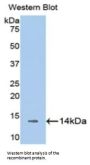 Melatonin Receptor 1A (MTNR1A) Antibody
