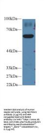 Pyruvate Kinase, Muscle (PKM2) Antibody