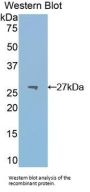 Pyruvate Kinase, Muscle (PKM2) Antibody