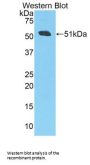 Amyloid Precursor Protein Antibody