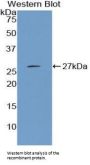 Cystathionine Gamma-Lyase (CTH) Antibody