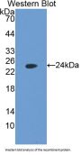 FK506 Binding Protein 7 (FKBP7) Antibody