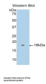 Forkhead Box Protein C1 (FOXC1) Antibody