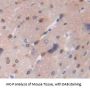 Forkhead Box Protein C1 (FOXC1) Antibody