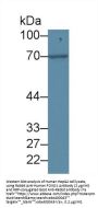 Forkhead Box Protein O1 (FOXO1) Antibody