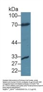 Forkhead Box Protein O1 (FOXO1) Antibody