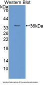 Glucose Transporter 14 / GLUT14 (SLC2A14) Antibody