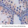 Glucose Transporter 14 / GLUT14 (SLC2A14) Antibody