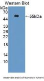 Hepatitis A Virus Cellular Receptor 1 (HAVCR1) Antibody