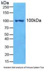 Nuclear Factor Kappa B2 (NFkB2) Antibody