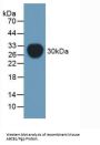ATP-Dependent Translocase ABCB1 (ABCB1) Antibody