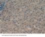 Protein Kinase C Epsilon (PKCe) Antibody