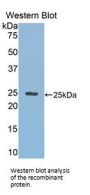 RalA Binding Protein 1 (RALBP1) Antibody