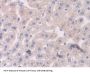 RalA Binding Protein 1 (RALBP1) Antibody