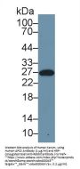 Serum Amyloid P Component (APCS) Antibody