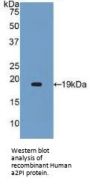 Alpha-2 Antiplasmin (SERPINF2) Antibody