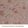 Cyclin Dependent Kinase 2 (CDK2) Antibody