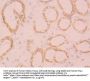 Fibrinogen Like Protein 1 (FGL1) Antibody