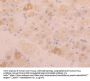 Fibrinogen Like Protein 1 (FGL1) Antibody