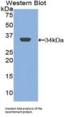 Macrophage Mannose Receptor 1 (MRC1) Antibody