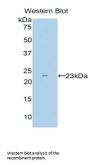 Mast/Stem Cell Growth Factor Receptor Kit (KIT) Antibody