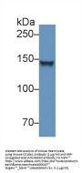 Collagen Type VI Alpha 1 (COL6A1) Antibody