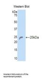 Collagen Type VI Alpha 1 (COL6A1) Antibody