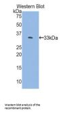 FK506 Binding Protein 10 (FKBP10) Antibody