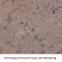 FK506 Binding Protein 10 (FKBP10) Antibody