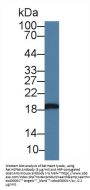 Heat Shock Protein Beta 6 (HSPb6) Antibody