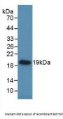 Heat Shock Protein Beta 6 (HSPb6) Antibody