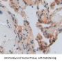 MMP8 Antibody