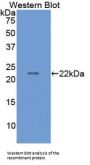 Matrix Metalloproteinase 9 (MMP9) Antibody