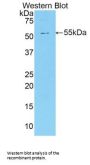 Sphingomyelin Phosphodiesterase 2 (SMPD2) Antibody