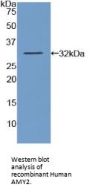 Amylase Alpha 2, Pancreatic (AMY2) Antibody