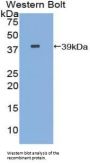 Carboxypeptidase B1, Tissue (CPB1) Antibody