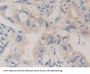 Carboxypeptidase B1, Tissue (CPB1) Antibody