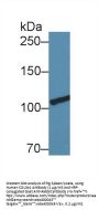 Collagen Type III Alpha 1 (COL3A1) Antibody
