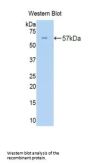 Collagen Type III Alpha 1 (COL3A1) Antibody