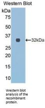 Collagen Type III Alpha 1 (COL3A1) Antibody
