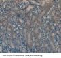 Follicle Stimulating Hormone (FSH) Antibody