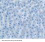IL17RB Antibody