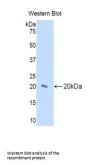 Interleukin 17 Receptor D (IL17RD) Antibody