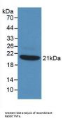 Tumor Necrosis Factor (TNF) Antibody